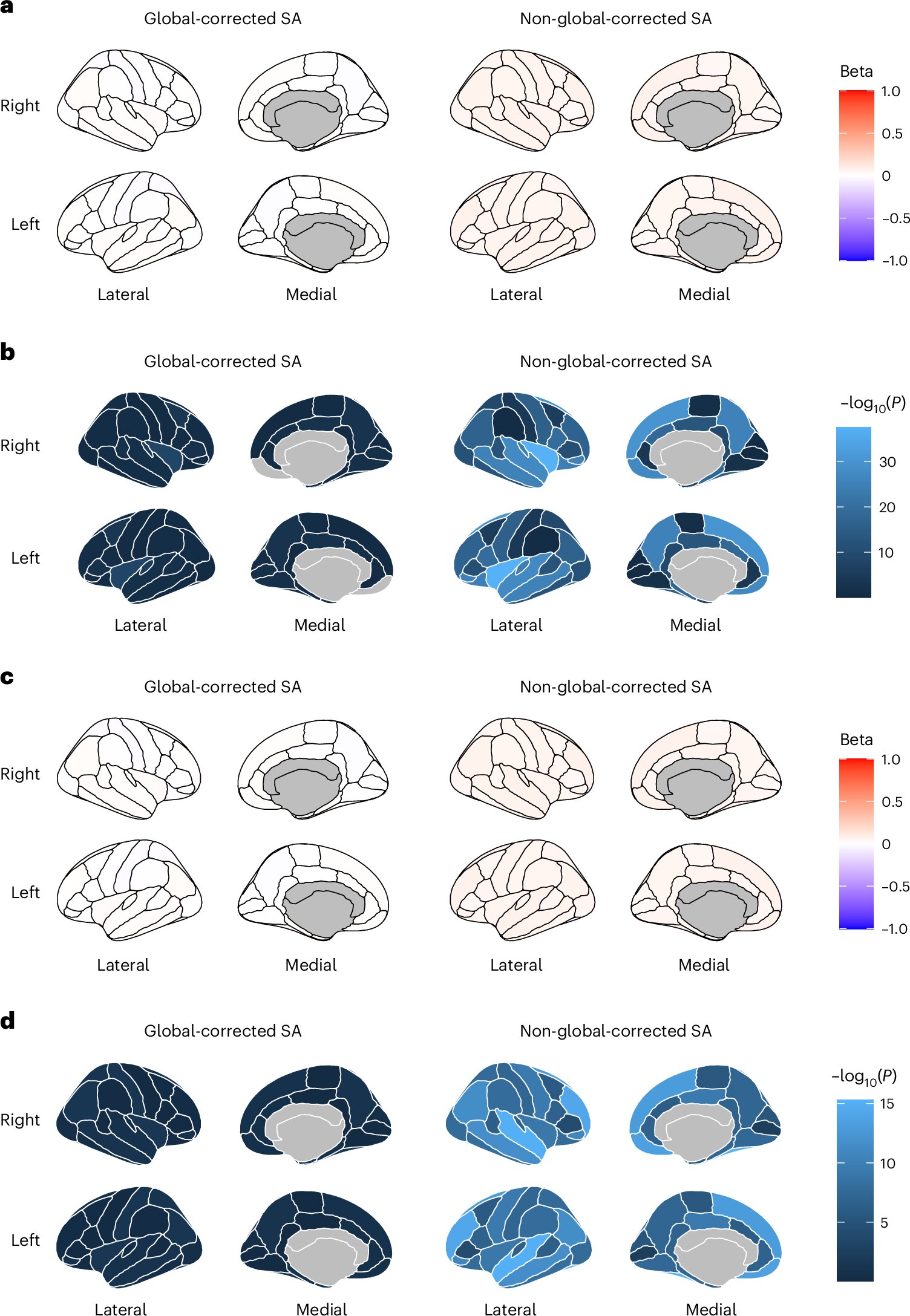 Brain cortex structure linked to mental abilities and psychiatric disorders