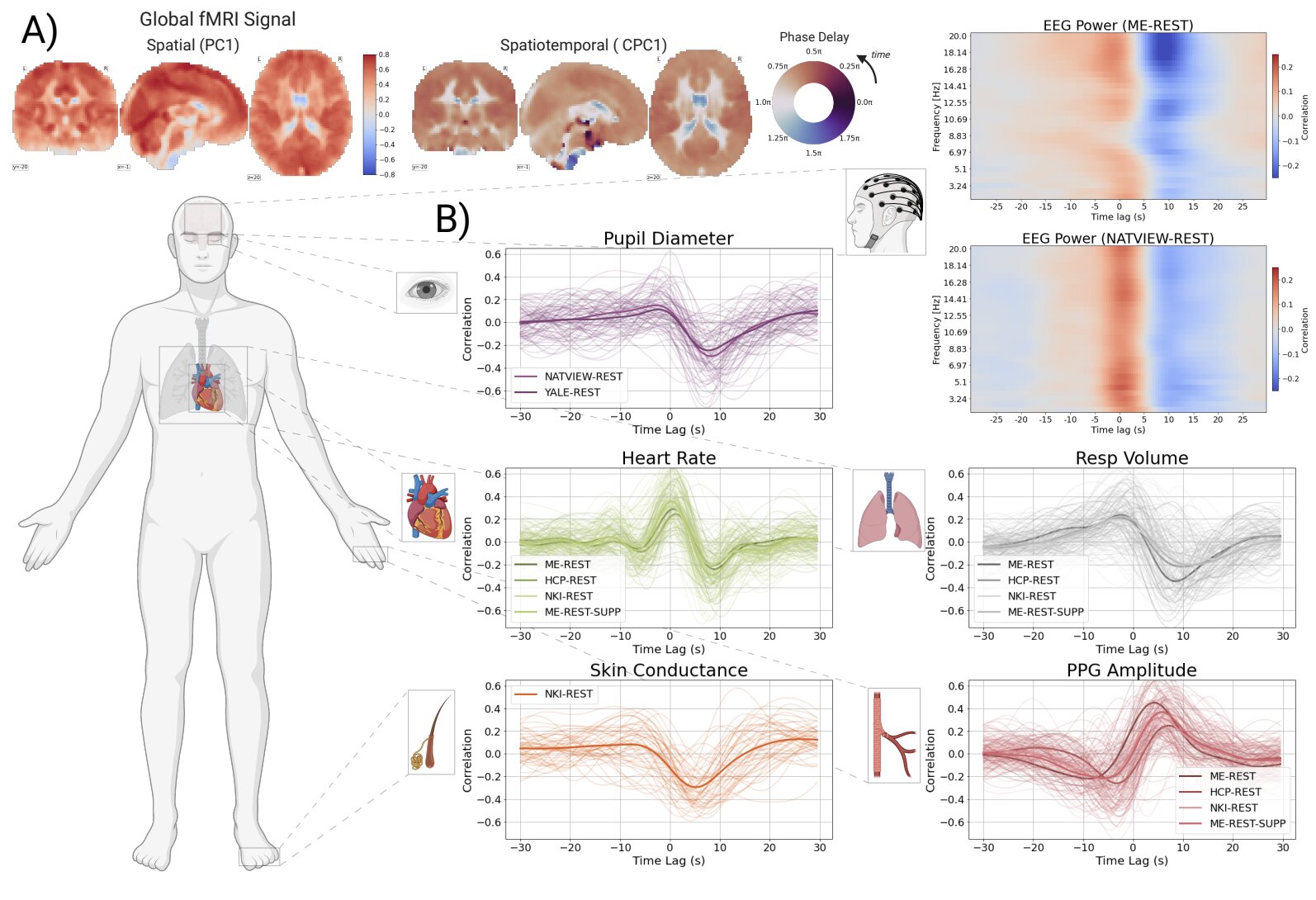 Autonomic nervous system is key driver of global fMRI signal, study finds