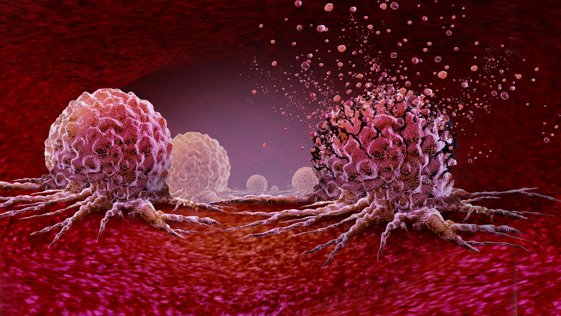 The 30-minute workout that could slash cancer cell growth by 30%
